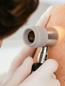 dr Meuleman dermatoloog